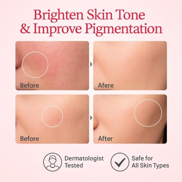 Anua Niacinamide 10% + Tranexamic Acid 4% Serum 30ml - Image 3