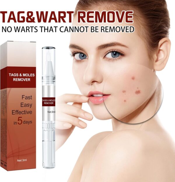 Liquid Warts Tags & Moles Remover - Image 6