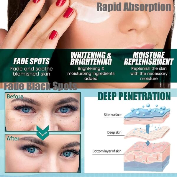 Dr Hancy White Spot Melasma cream - Image 4