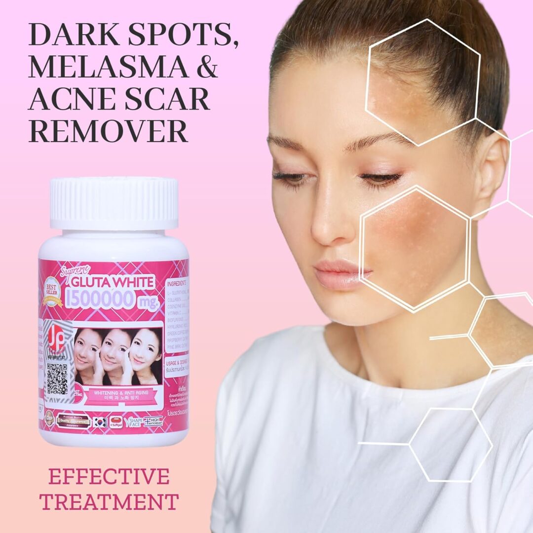 Alternative view of Supreme Gluta