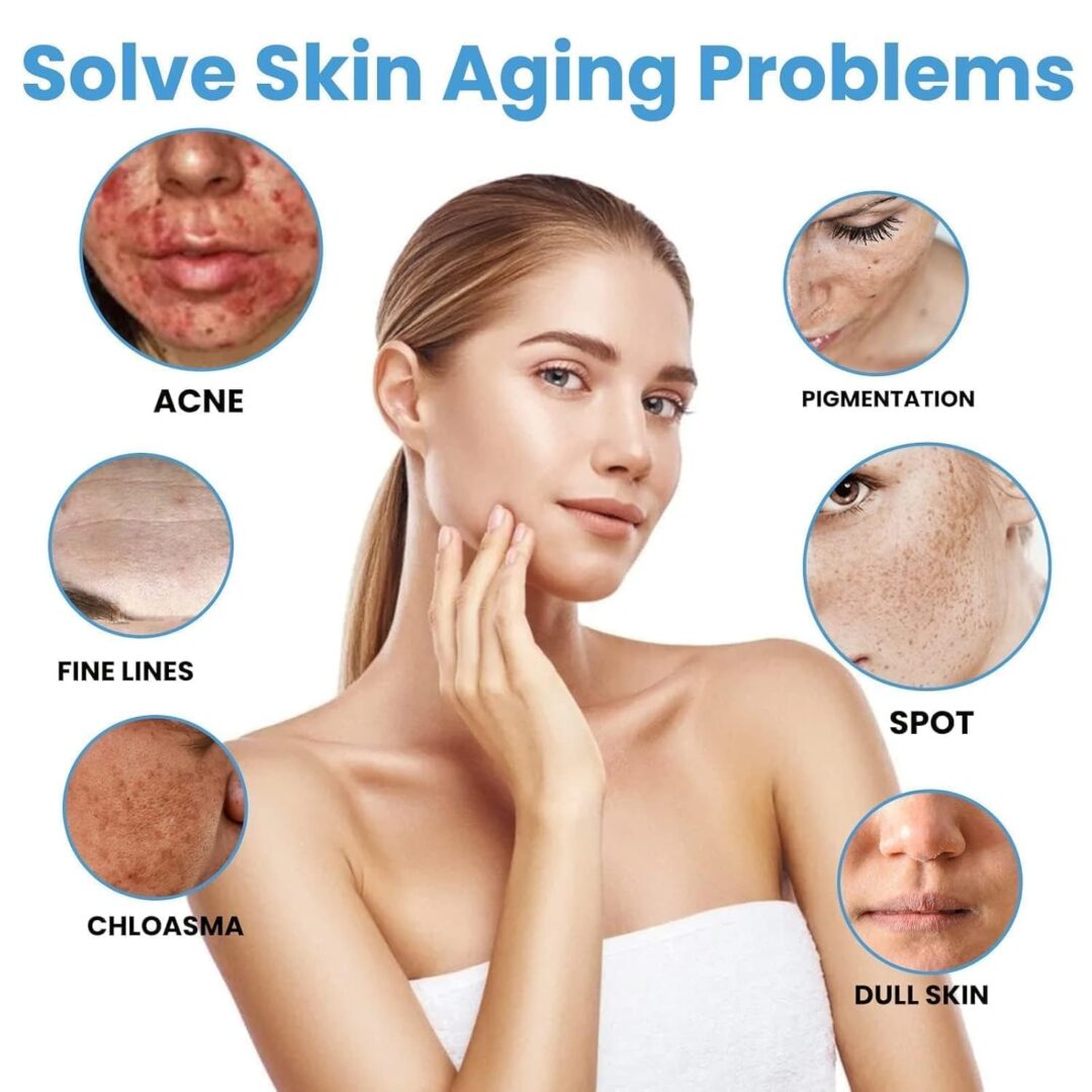 Alternative view of Nicotinamide Whitening & Freckle Care 20g