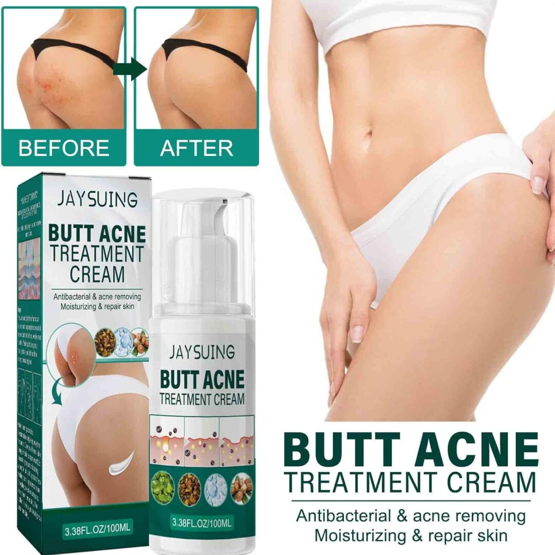 Alternative view of Acne Cream for Butt & Thighs   100ml