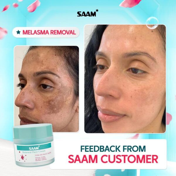 Saam Melasma Cream 50g - Image 2