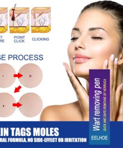 Alternative view of Wipe Off Tags & Mole Remover, Fast Easy Effective