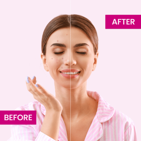Face Fresh L-Glutathione Ampoule 5ml - Image 6