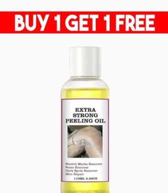 Extra Strong  Yellow Peeling Oil 120ml