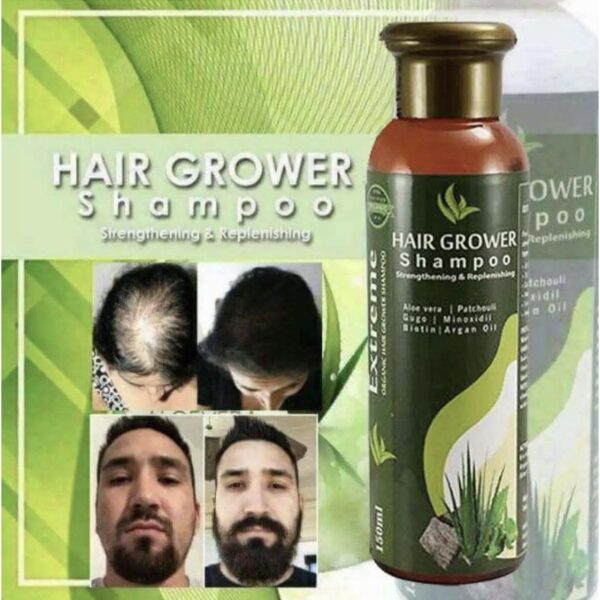 Sunisa Hair Growth Shampoo 150ml - Image 5