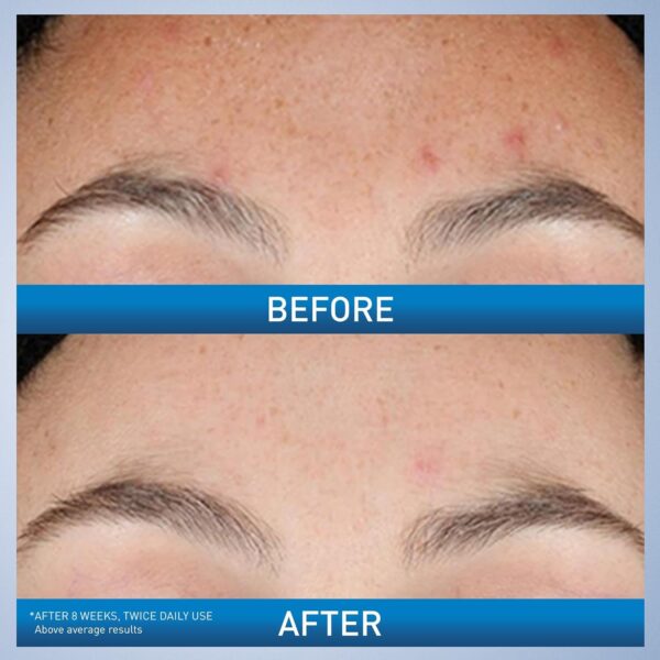 CeraVe Resurfacing Retinol Serum 30 Grams - Image 5