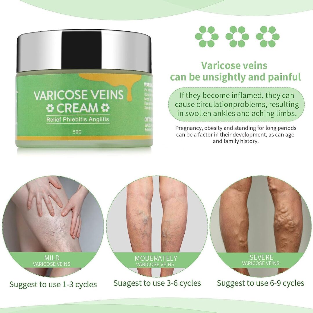 Alternative view of SEFUDUN Varicose Veins Cream Relief Phlebitis Angiitis 50g