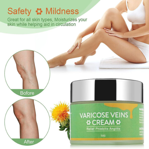 SEFUDUN Varicose Veins Cream Relief Phlebitis Angiitis 50g