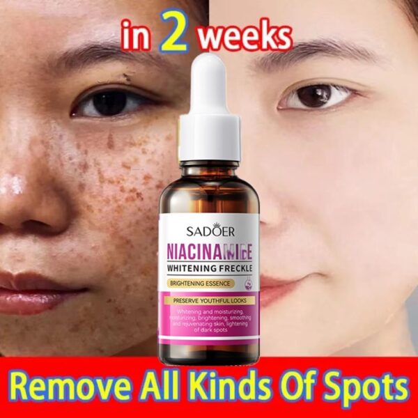Sadoer Niacinamide Brightening Essence 30ml - Image 2