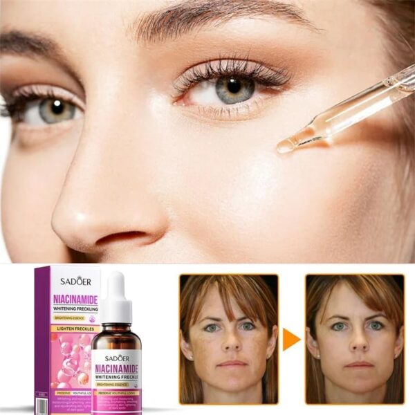 Sadoer Niacinamide Brightening Essence 30ml - Image 3