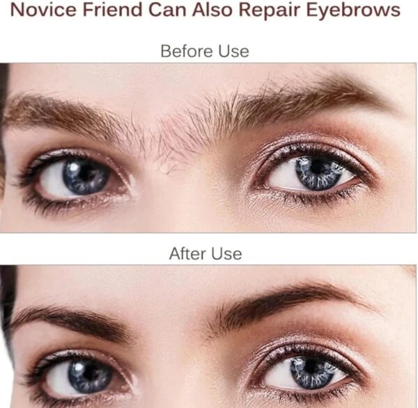 2 in 1 Facial Women Hair Remover - Image 3