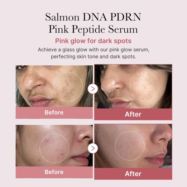 Medicube PDRN Pink Peptide Serum 30ml - Image 2