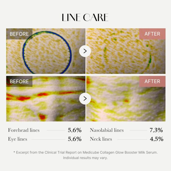 Medicube Collagen Glow Boosting Serum 15ml - Image 3
