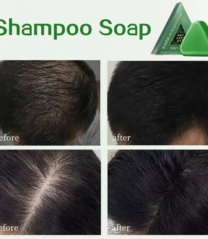 Nature Seven Green Soap Shampoo Bar (4)